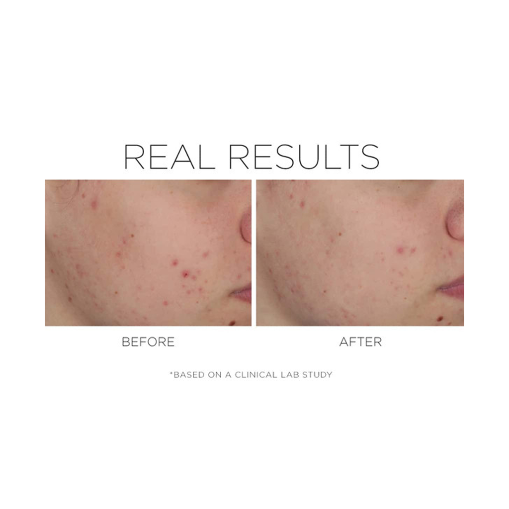 COSMEDIX - SHINELESS - OIL FREE MOISTURIZER (79 GM) - MyVaniteeCase