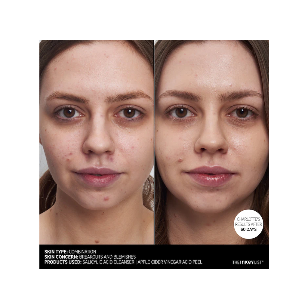 The INKEY List - Salicylic Acid Acne + Pore Cleanser (150ml) - MyVaniteeCase