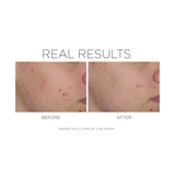 COSMEDIX - SHINELESS - OIL FREE MOISTURIZER (79 GM) - MyVaniteeCase